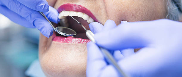 Best Emergency Tooth Extraction in Sunbury, PA